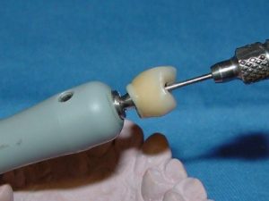 Acabamento da margem cimentada da TiBase